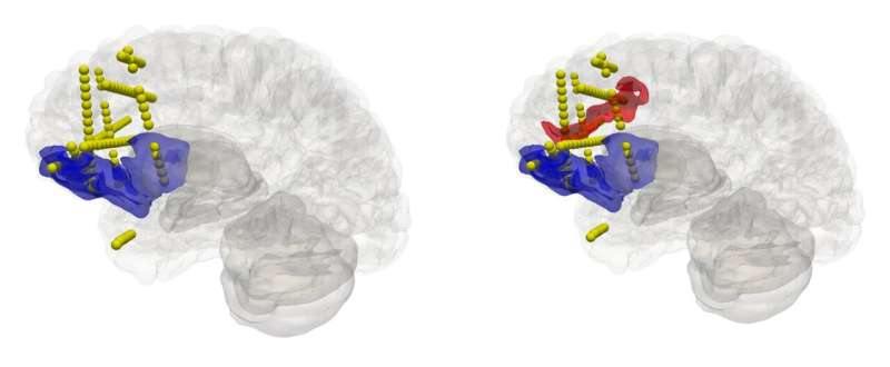「人脑计划」研究：大脑建模的进步为脑医学的「数字孪生」方法开辟道路
